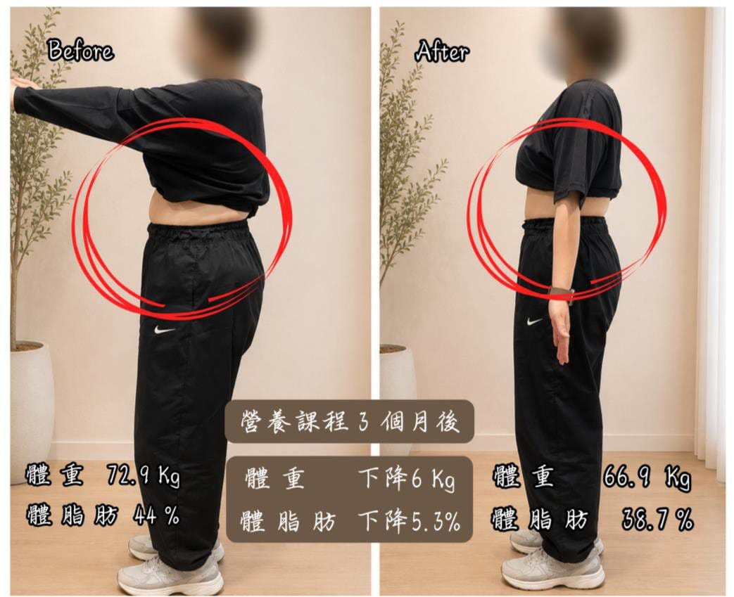 過了奇幻的三個月！多囊調理，三個月減近 7 公斤 側面前後對比